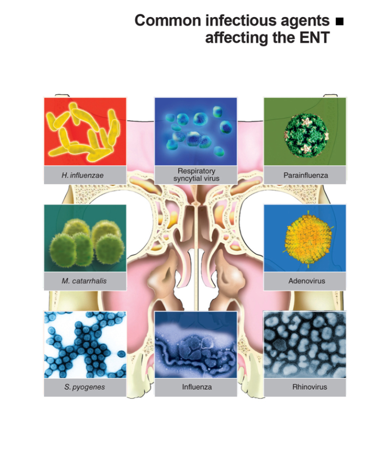 Common Infectious Agents