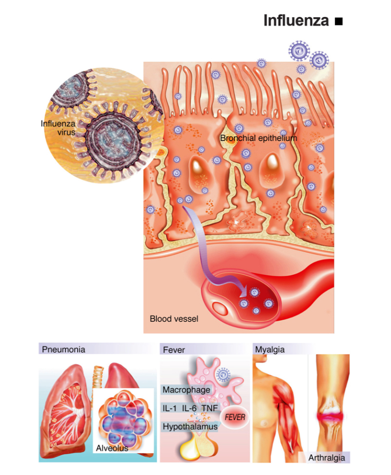 Influenza